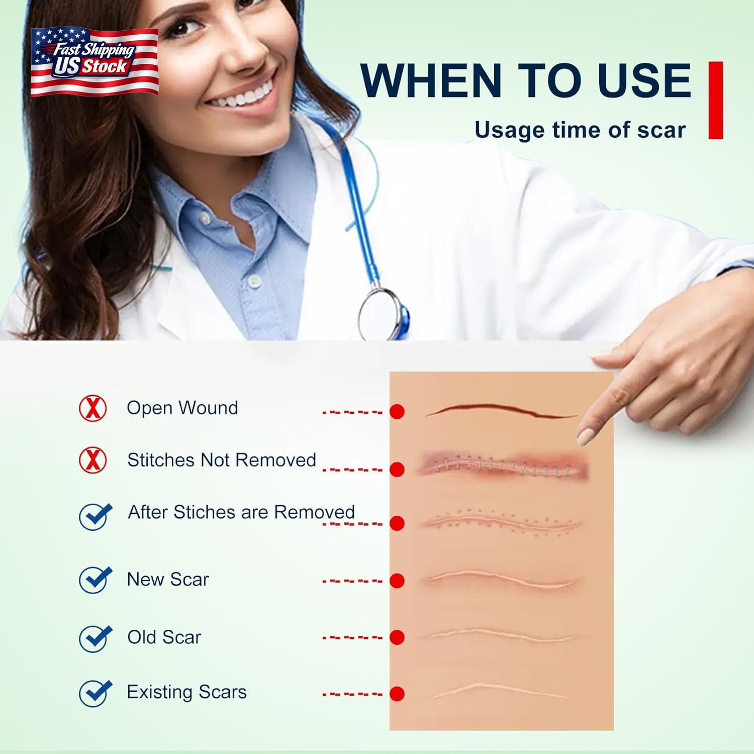 Silicone Scar Sheets (1.6” X 120” Roll-3M), Silicone Scar Tape Roll, Scar Silico