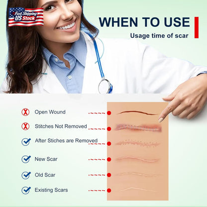 Silicone Scar Sheets (1.6” X 120” Roll-3M), Silicone Scar Tape Roll, Scar Silico